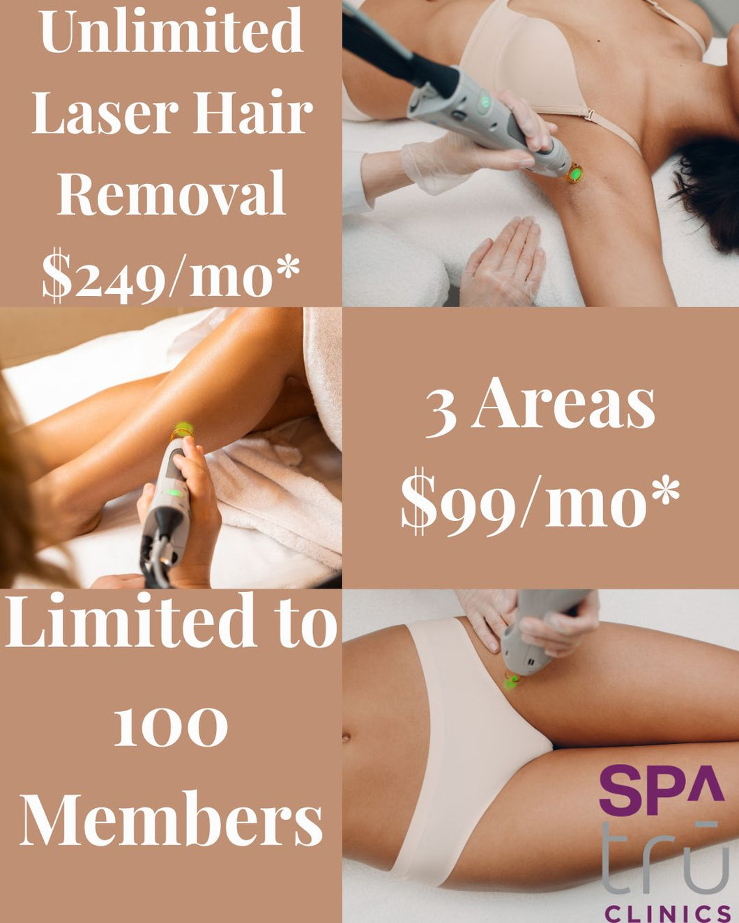 Laser Hair Membership Deposit